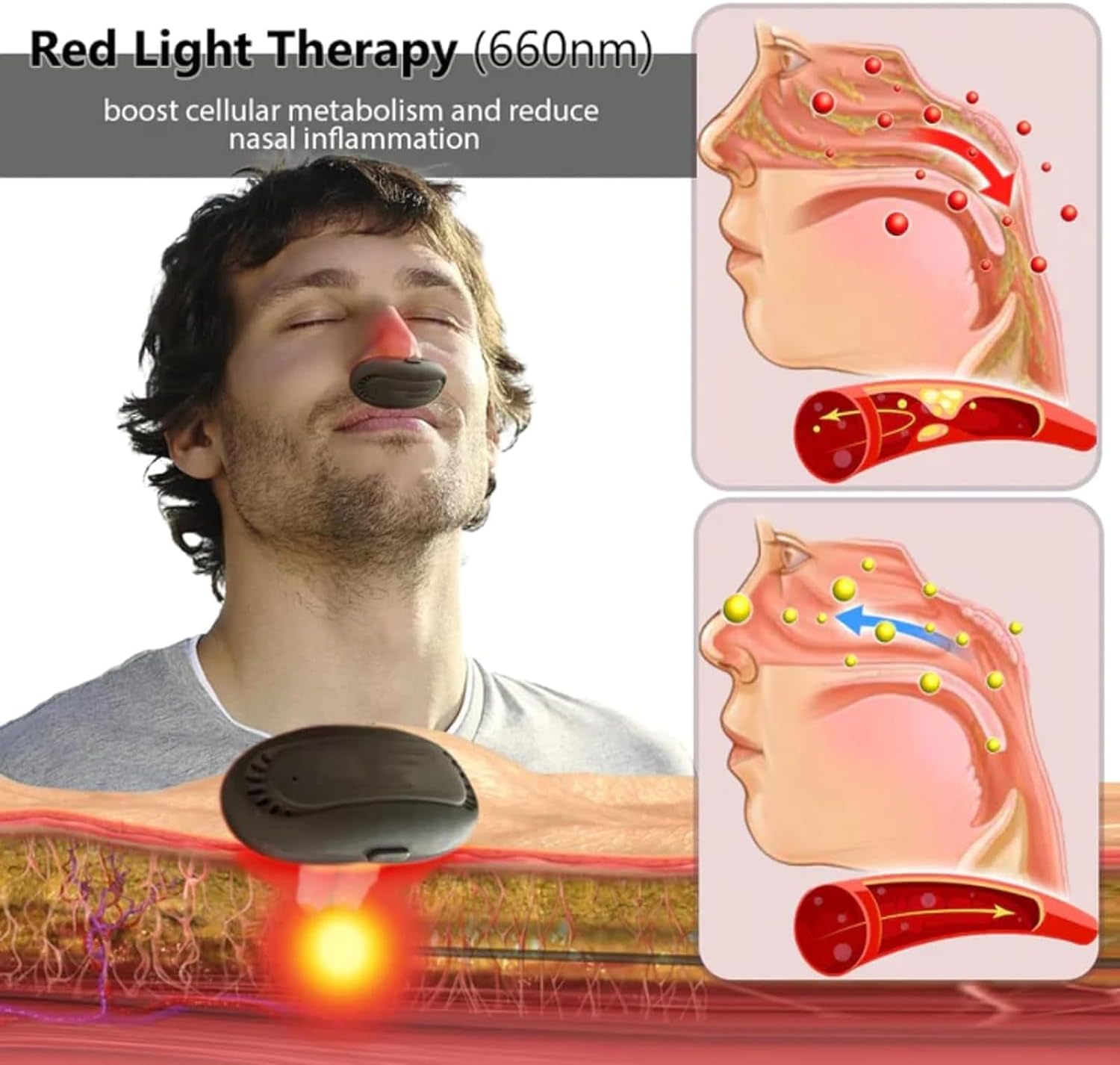 Red Light Therapy Device for Nasal Allergy & Rhinitis